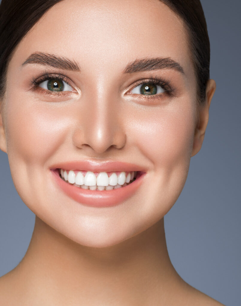 Best Teeth Whitening the colony