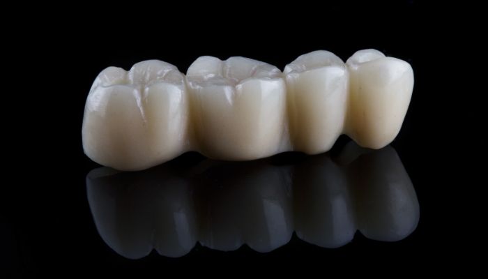 Dental Crowns