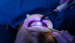 early orthodontics treatment