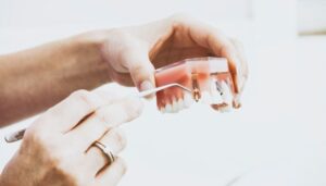 How Lifestyle Choices Impact the Longevity of Your Dental Implants